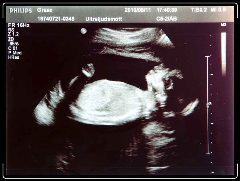 Du har n�tt sista bilden