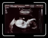 MG_9890 * 3708 x 2790 * (776KB)