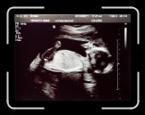 MG_9891 * 3804 x 2844 * (922KB)