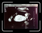 MG_9896 * 3648 x 2706 * (996KB)